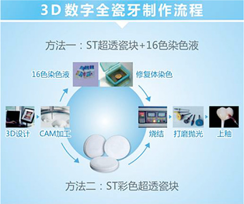 口腔專區(qū)項(xiàng)目詳情 數(shù)字內(nèi)容制作服務(wù)全面解析